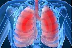 Tuberculose sintomas